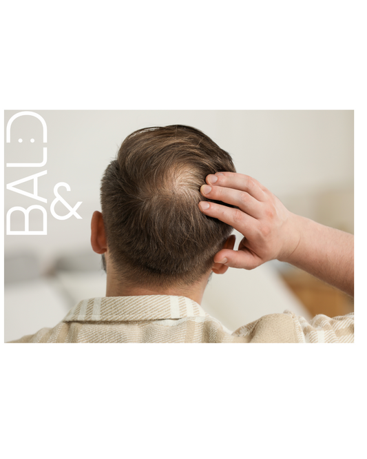 What to Do About a Bald Spot on Your Head: Causes, Solutions, and Tips.