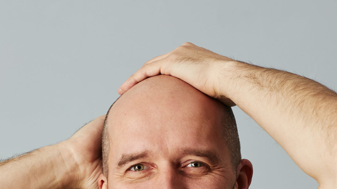 How to Best Care for Your Bald Head: A Simple Step-by-Step Guide for Optimal Care